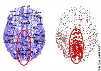 Núcleo cerebral